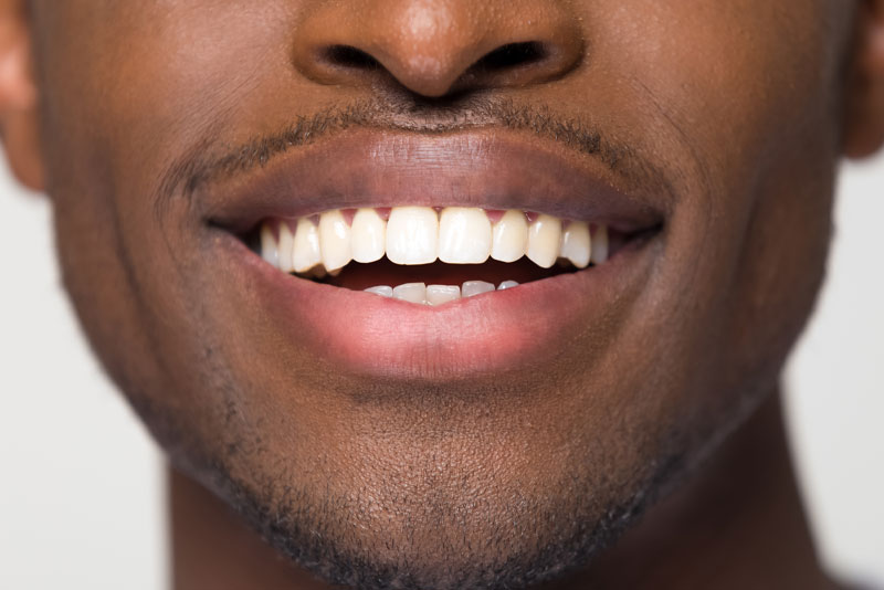 dental patient smiling after tooth extraction